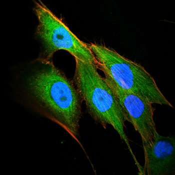 MS4A1 Antibody