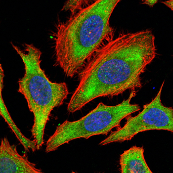 GRIA2 Antibody