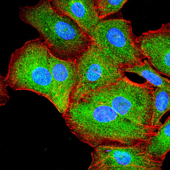 HK1 Antibody