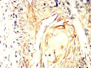 HK1 Antibody