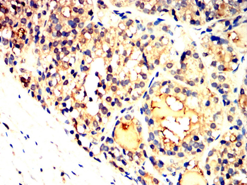 HK1 Antibody