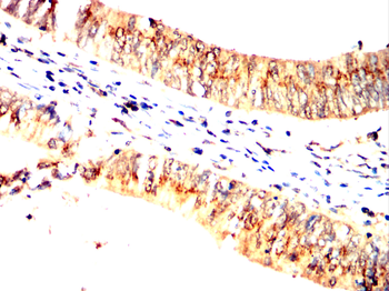 AXIN2 Antibody