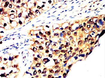 UBA1 Antibody