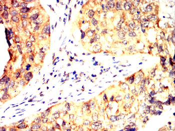 TUBG1 Antibody