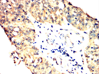 TUBG1 Antibody