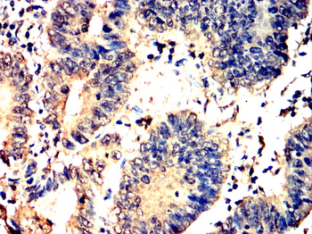 ARNT Antibody