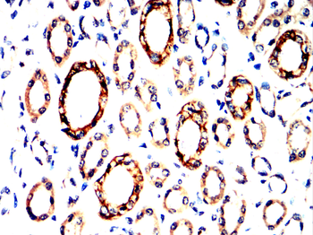 HSPH1 Antibody