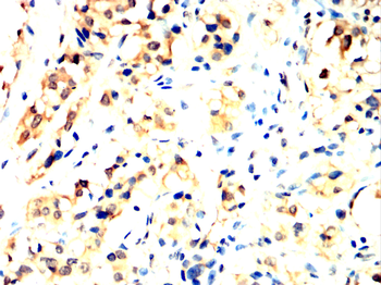 FTL Antibody