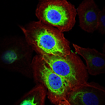 CALD1 Antibody