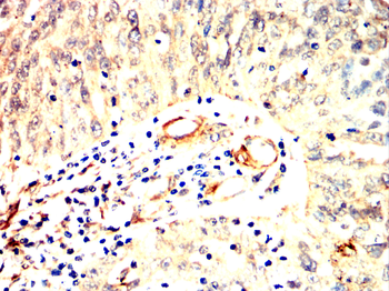 CALD1 Antibody