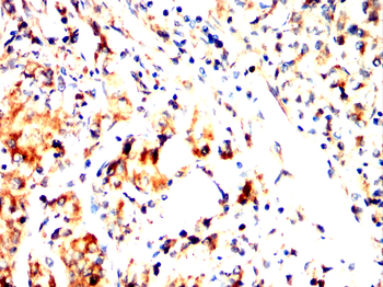 CALD1 Antibody