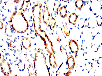 ATP2A2 Antibody