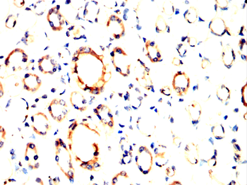 TOP2A Antibody