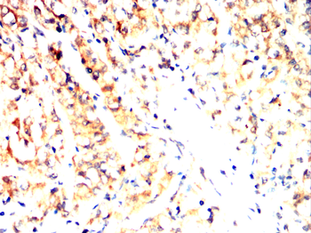 TOP2A Antibody