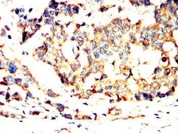 KIF23 Antibody