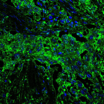 MDM2 Antibody