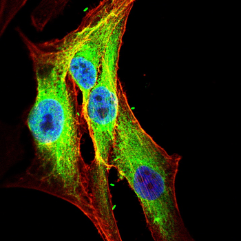 CHRNB1 Antibody
