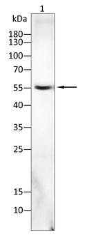 CHRNB1 Antibody