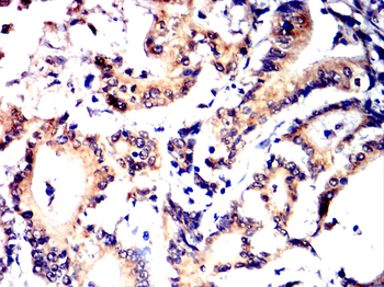 ALB Antibody