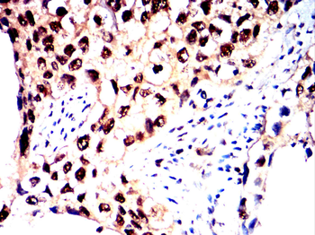 FOS Antibody
