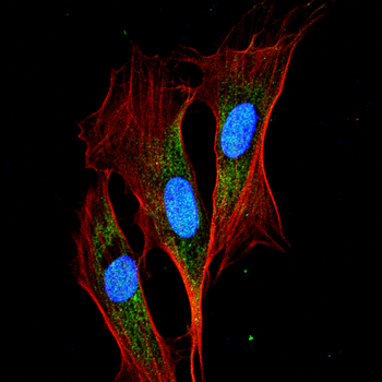 BRAF Antibody