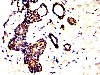 BRAF Antibody
