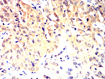 BRAF Antibody