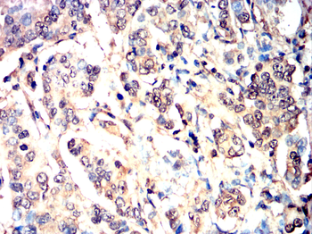 ATM Antibody