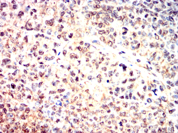 ATM Antibody