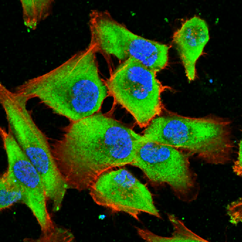 MCSF Rabbit Polyclonal Antibody