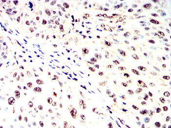 NFKBIA Antibody