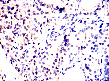 LIG4 Antibody