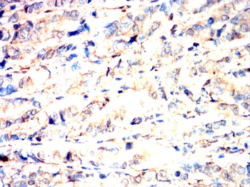CTTN Antibody