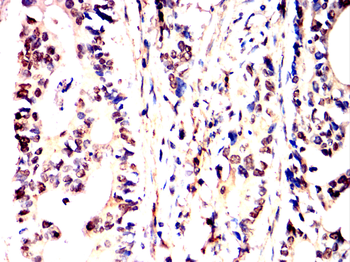 HNRNPK Antibody