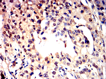 FTH1 Antibody