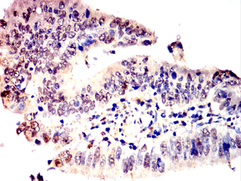 FTH1 Antibody