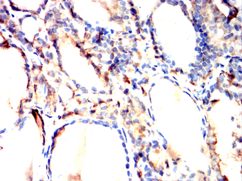 ADK Antibody