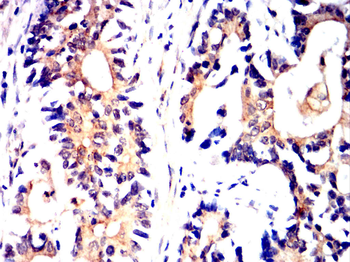 ADK Antibody