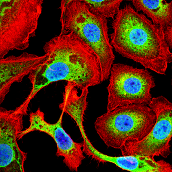 HIF1AN Rabbit Polyclonal Antibody