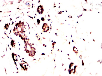 HIF1AN Rabbit Polyclonal Antibody