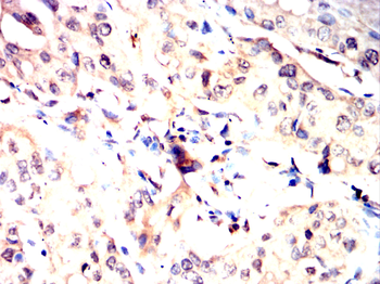 HIF1AN Rabbit Polyclonal Antibody