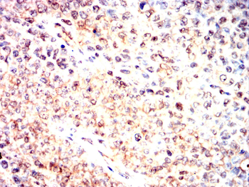 HIF1AN Rabbit Polyclonal Antibody