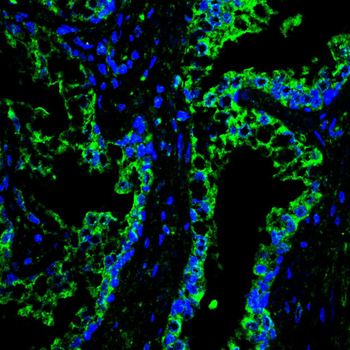 HIF1AN Rabbit Polyclonal Antibody