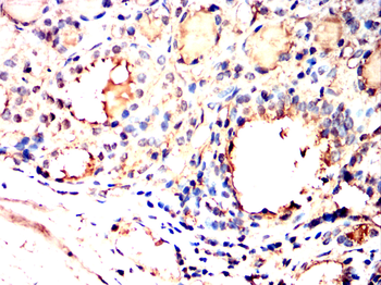 HIF1AN Rabbit Polyclonal Antibody