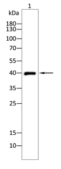 HIF1AN Rabbit Polyclonal Antibody