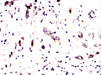 PPT1 Antibody