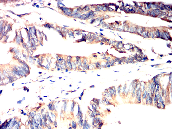 PPT1 Antibody