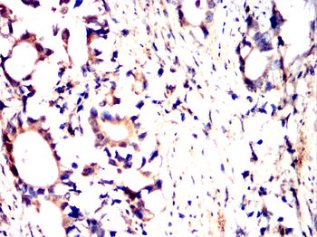 PPT1 Antibody