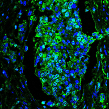 MCM3 Antibody