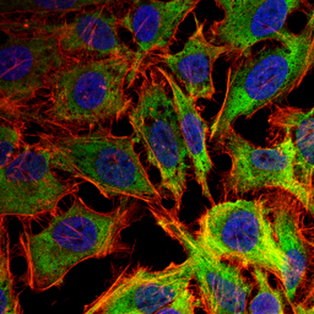 GARS1 Antibody